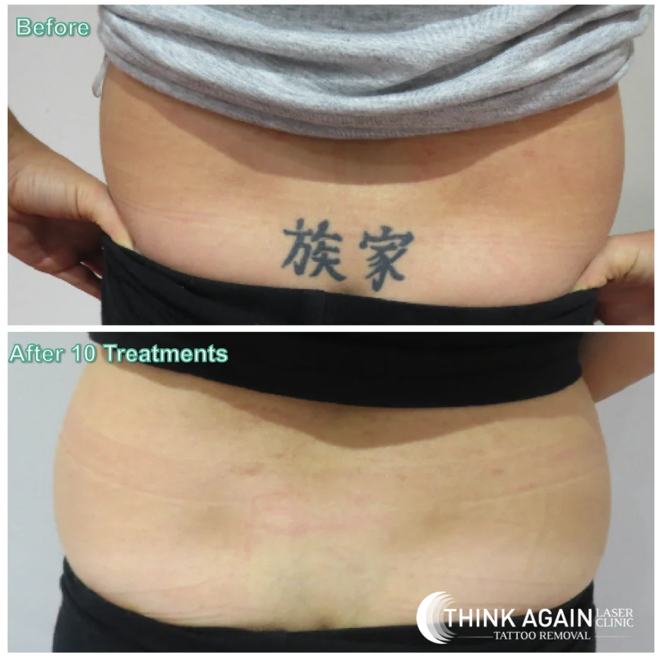 Think Again Laser Clinic - Penrith - 2